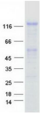 Coomassie blue staining of purified FGFR1 protein.